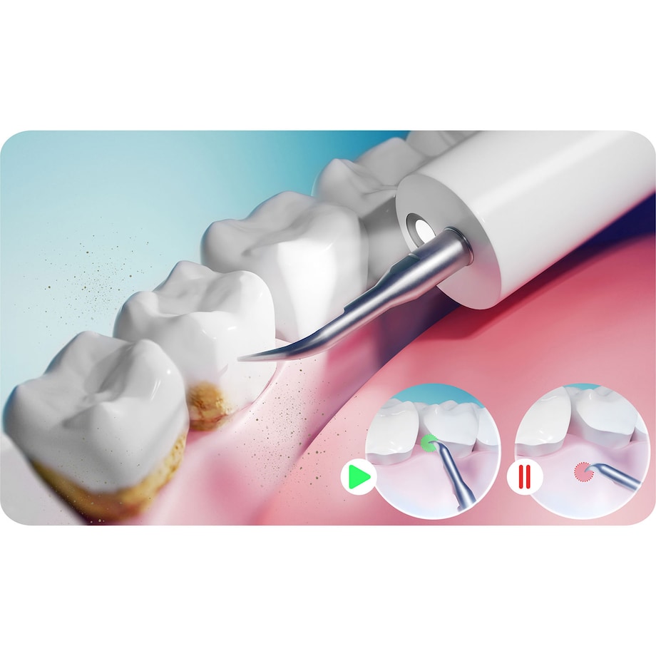 Skaler Ultradźwiękowy do zębów do usuwania kamienia Berdsen 325100